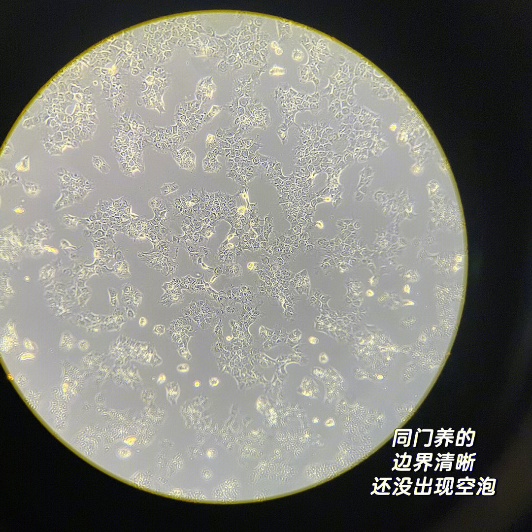 aml12小鼠肝细胞