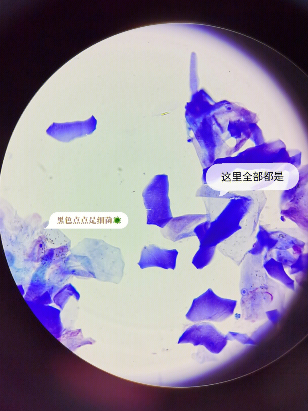 猫小孢子菌镜检图片图片