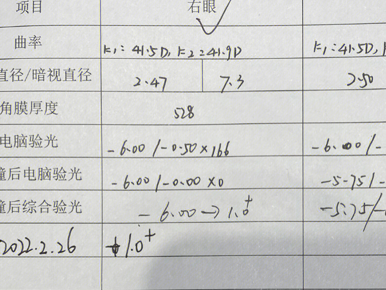 测试的时候打了个哈欠,测出来数据也是正常的医生说就是暗瞳比较大