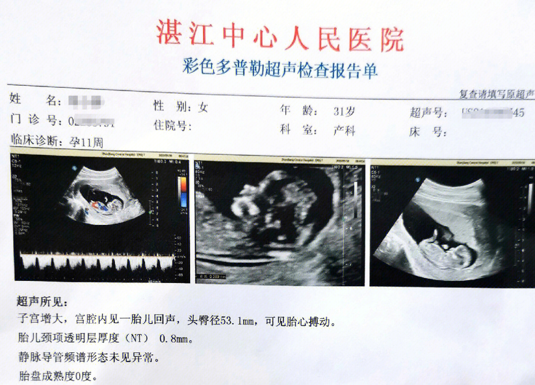 晚孕疤痕超声测量图片图片