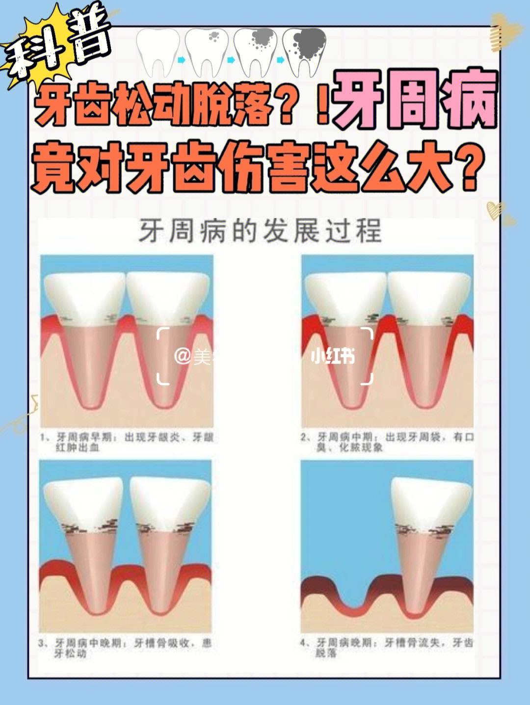 牙周炎10大症状1