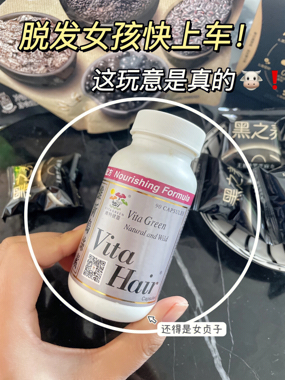 九敏真有你的把头发焊在头皮上