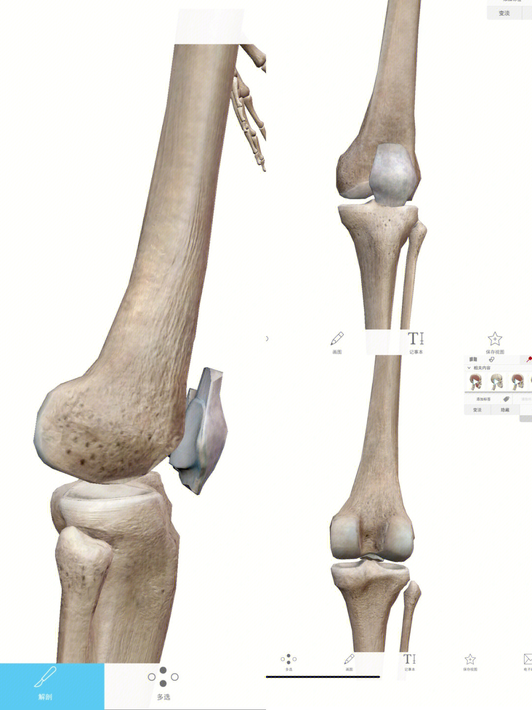 今天来看一下膝关节的骨性膝关节:股骨,髌骨,胫骨构成—髌股关节