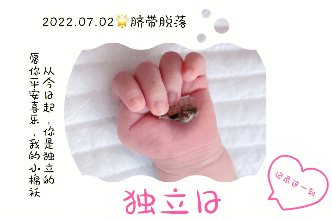 婴儿脐带掉的过程图片图片