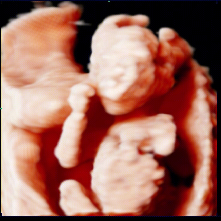 孕16周胎儿真实图男孩图片