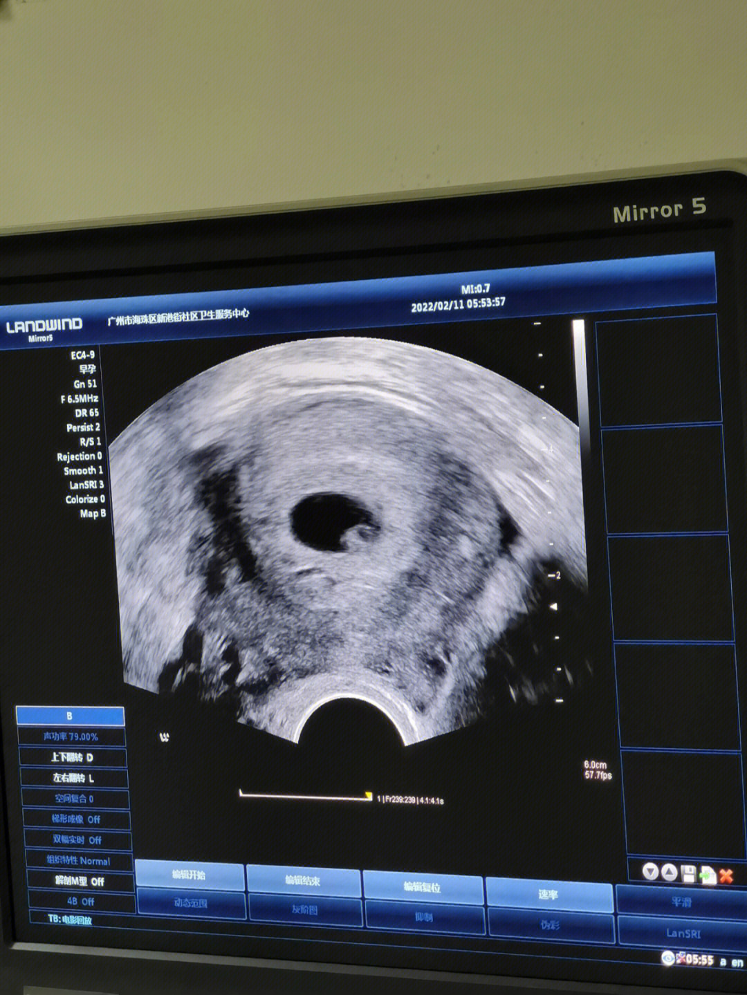 胎儿七周有多大图片图片