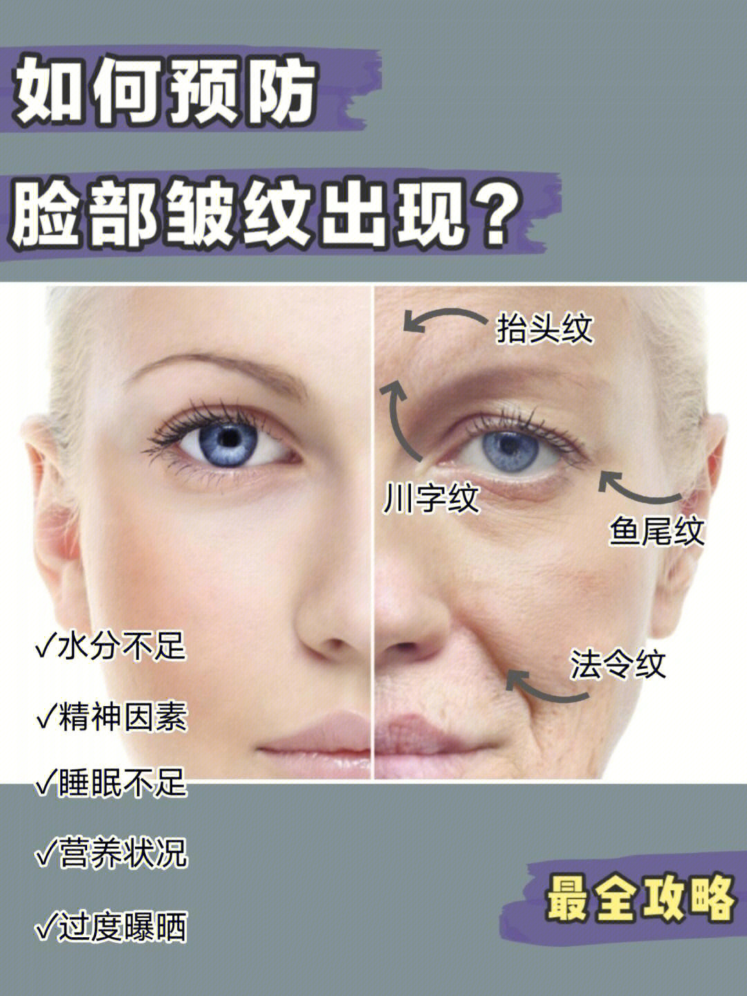 727225岁的你如何预防脸部皱纹出现