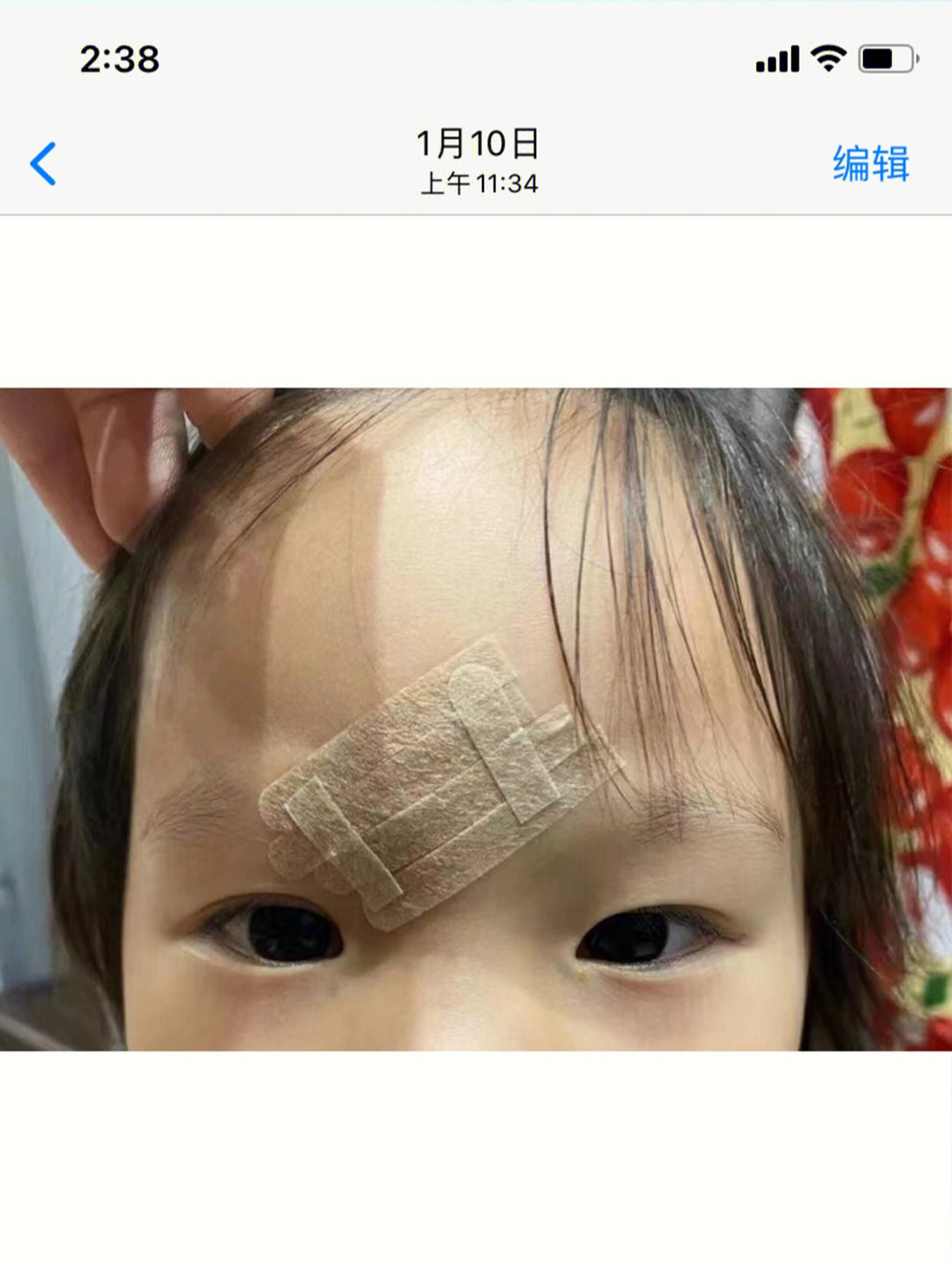 就在眼前孩子还是一不小心磕到了额头,伤口也一直在流血00,旁边宝妈