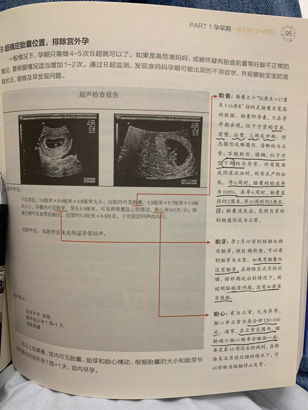 孕囊长宽高示意图图片