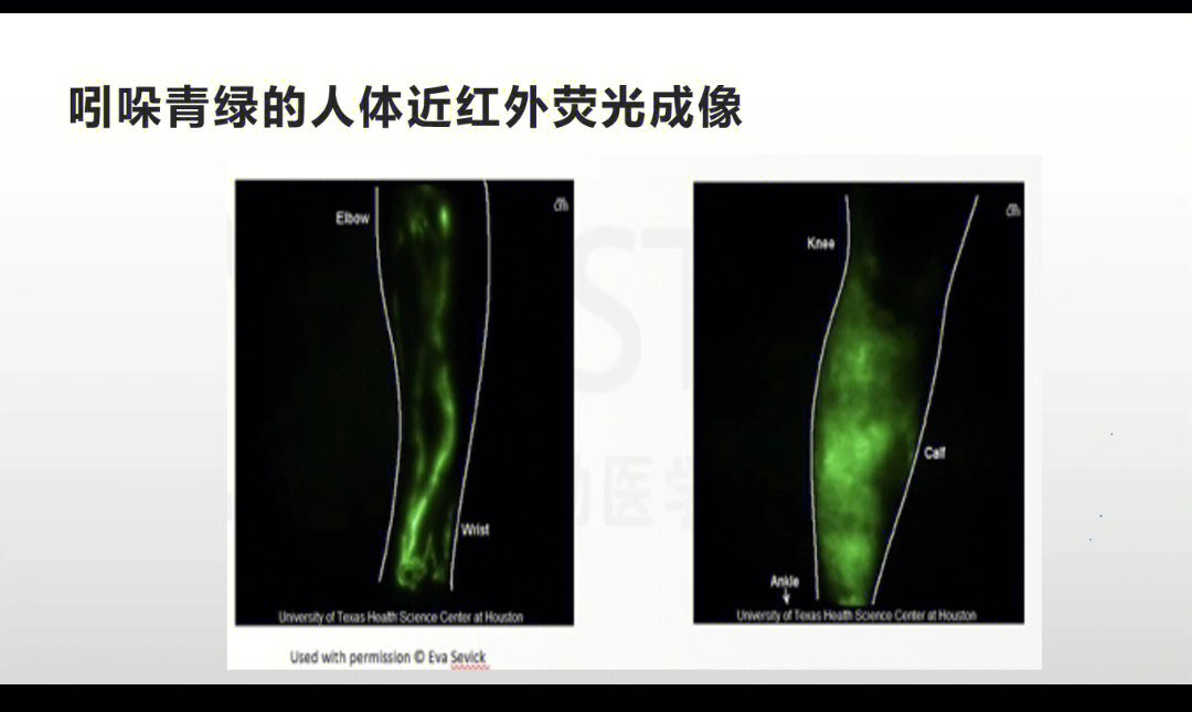 淋巴引流促进免疫力瘦身强推