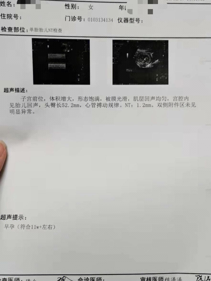 nt检查结果图片