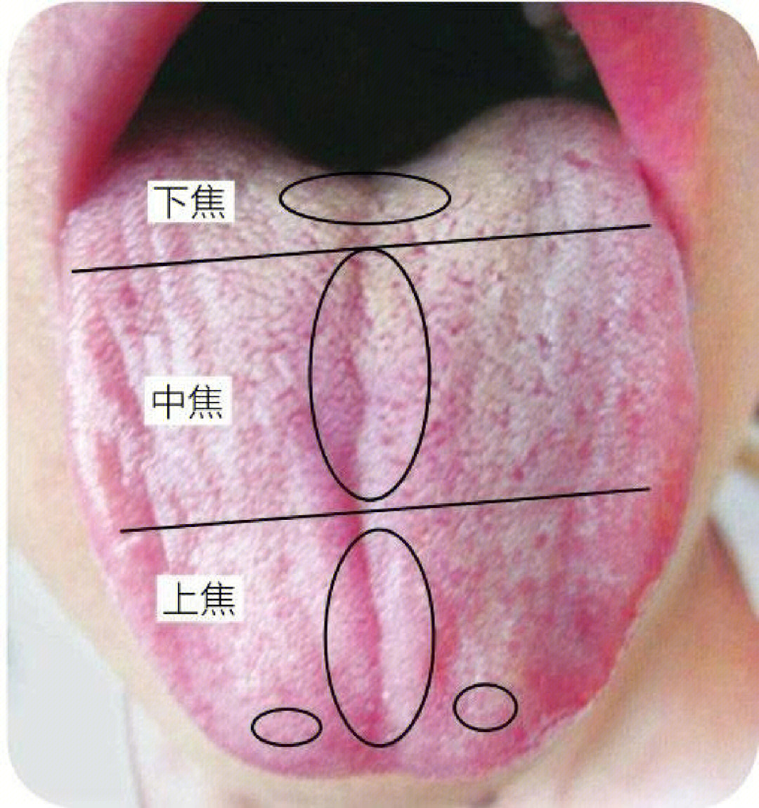 小儿舌诊辨证图谱讲解图片