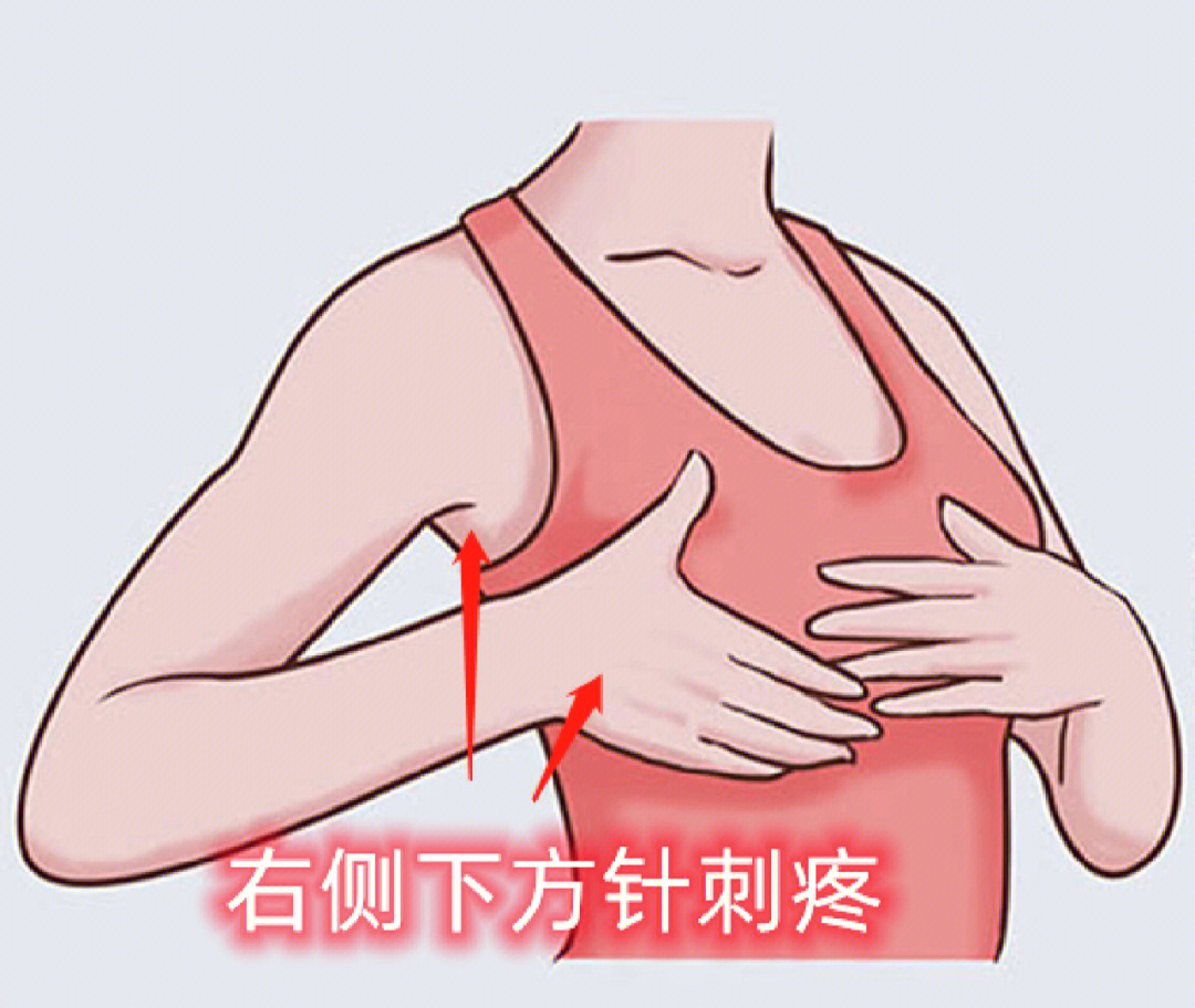 乳腺增生位置图片图片