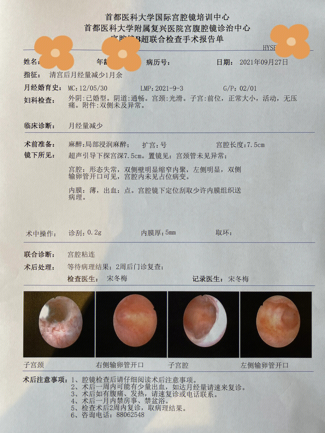 复兴医院宫腔镜检查 宫腔粘连