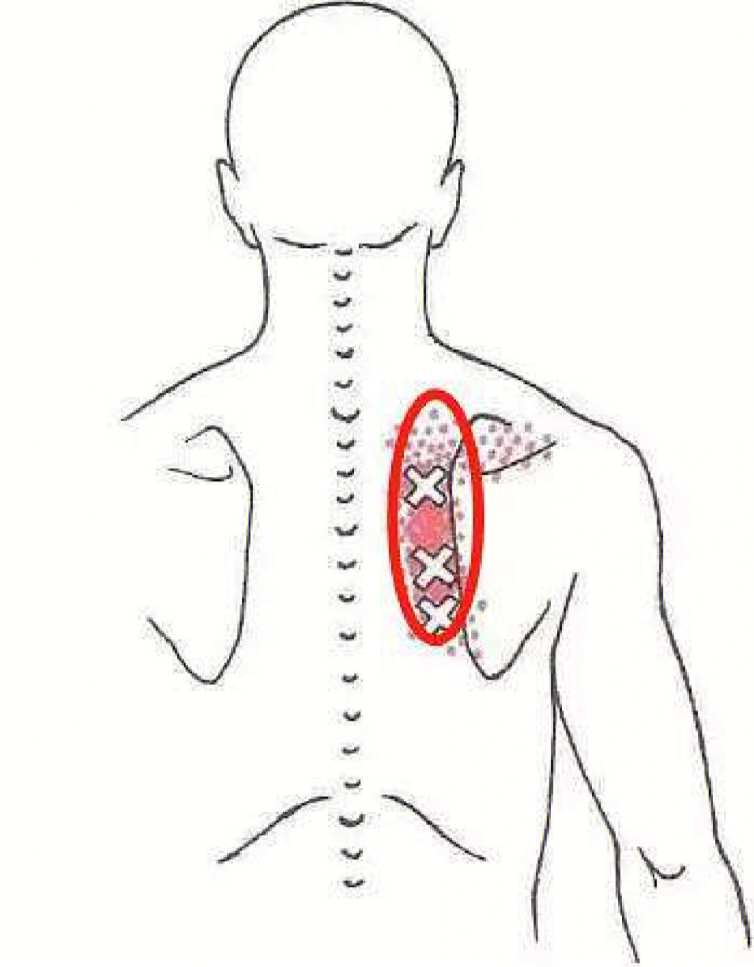 肩胛骨位置图片