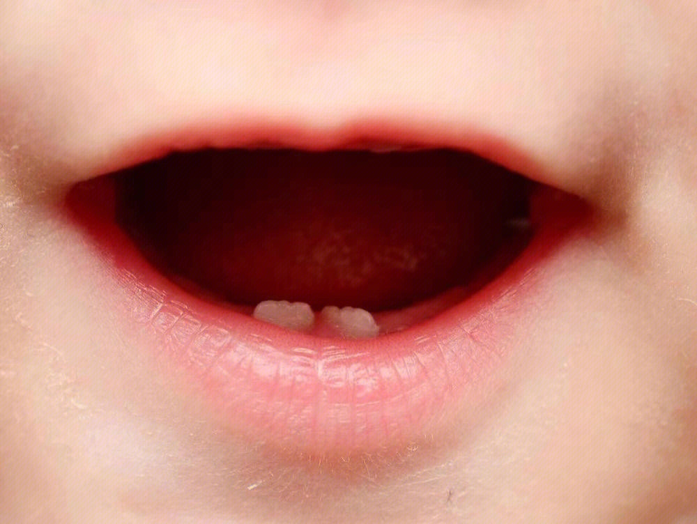 婴儿牙龈发黑未出牙图片