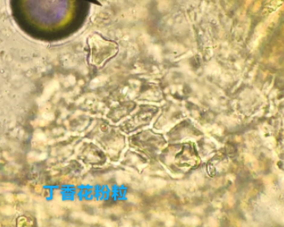 百合花花粉粒显微图图片