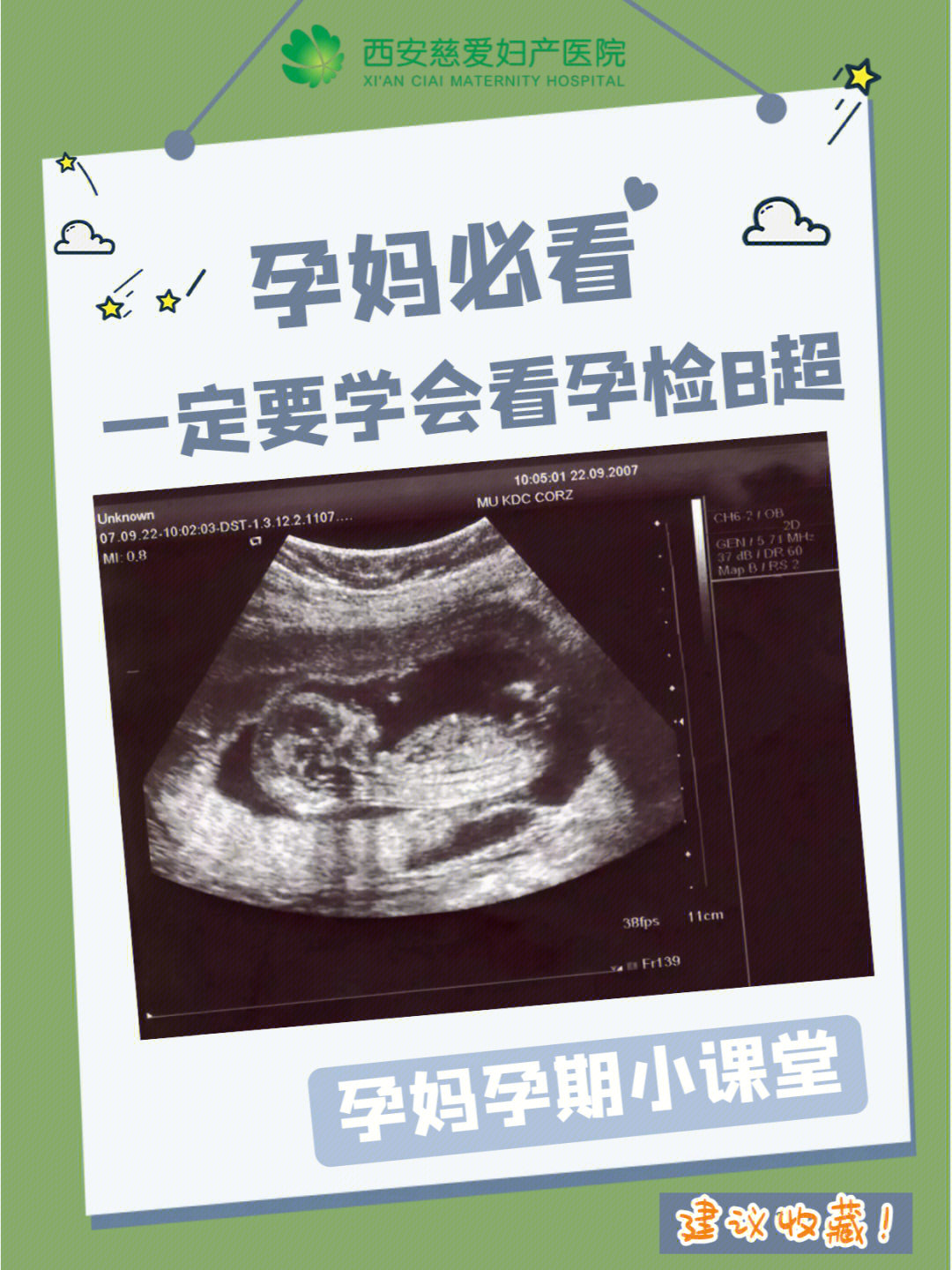 73孕囊/妊娠囊:孕早期见到,大小用长宽高衡量