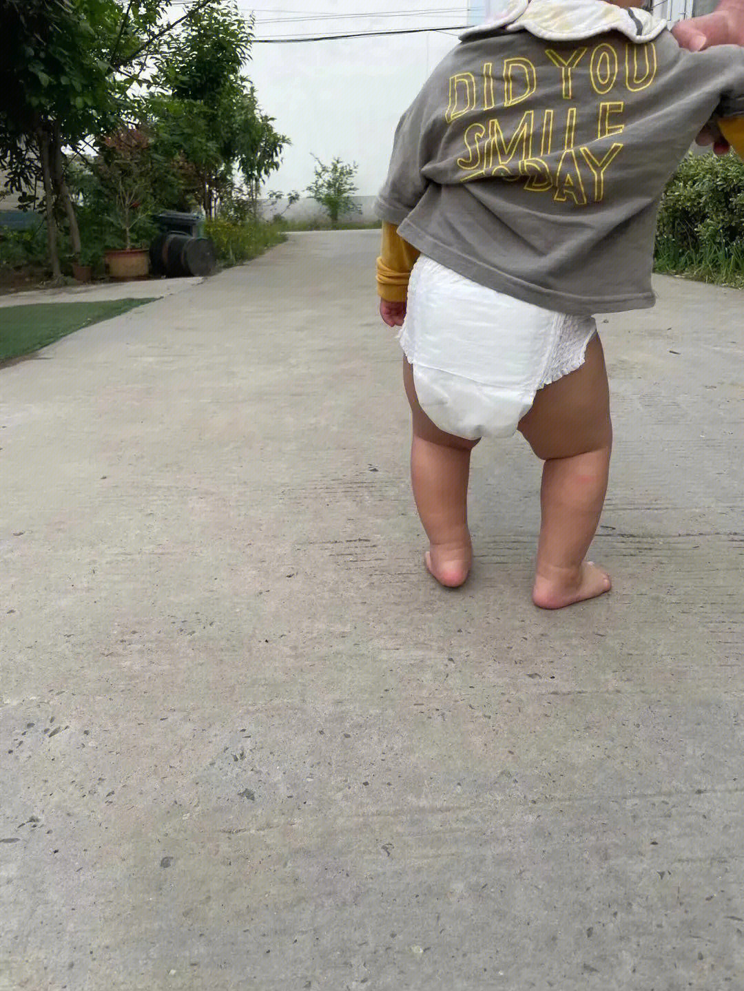 15个月的宝宝走路内八o型腿