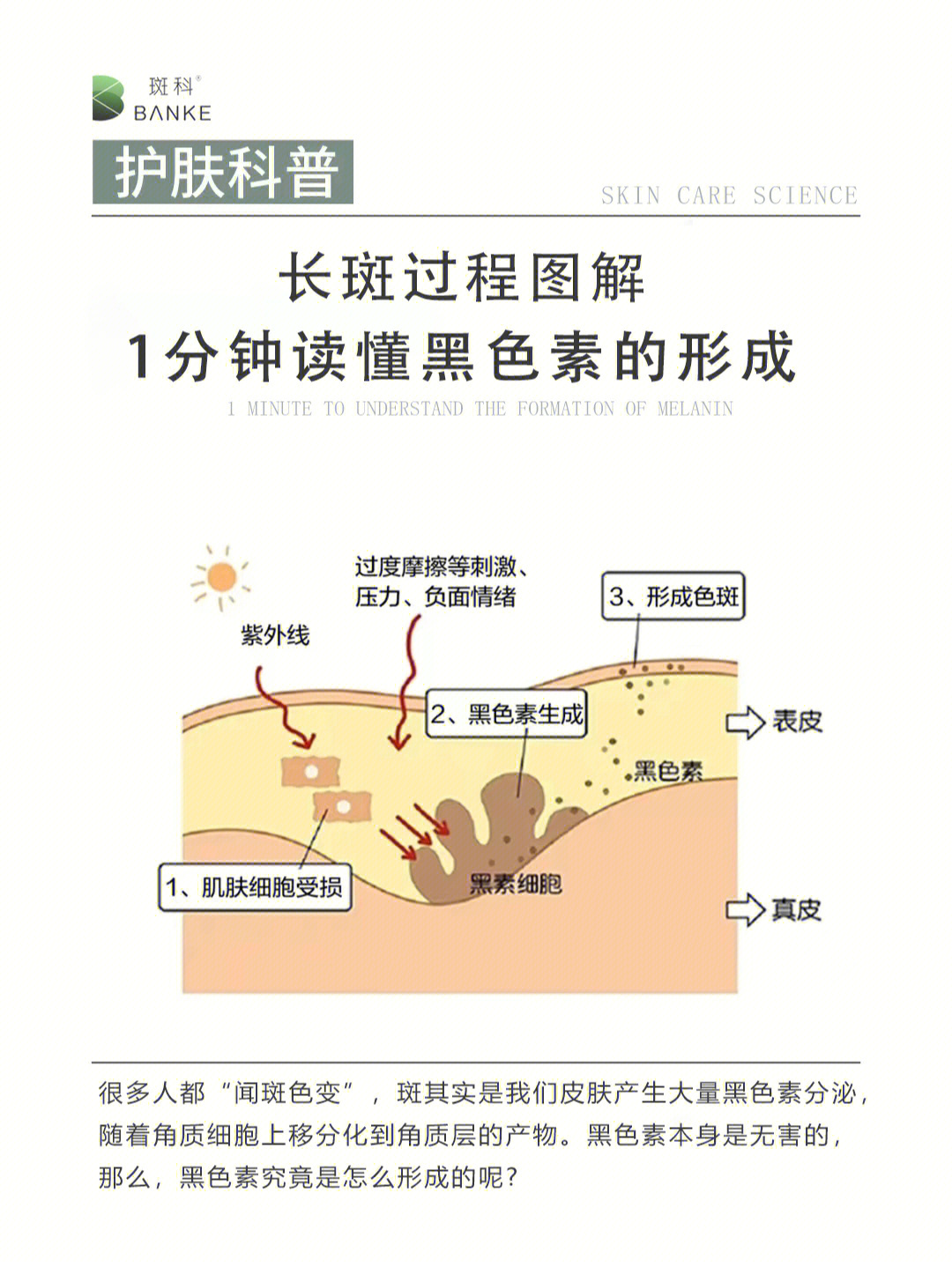 色素带的分布图图片