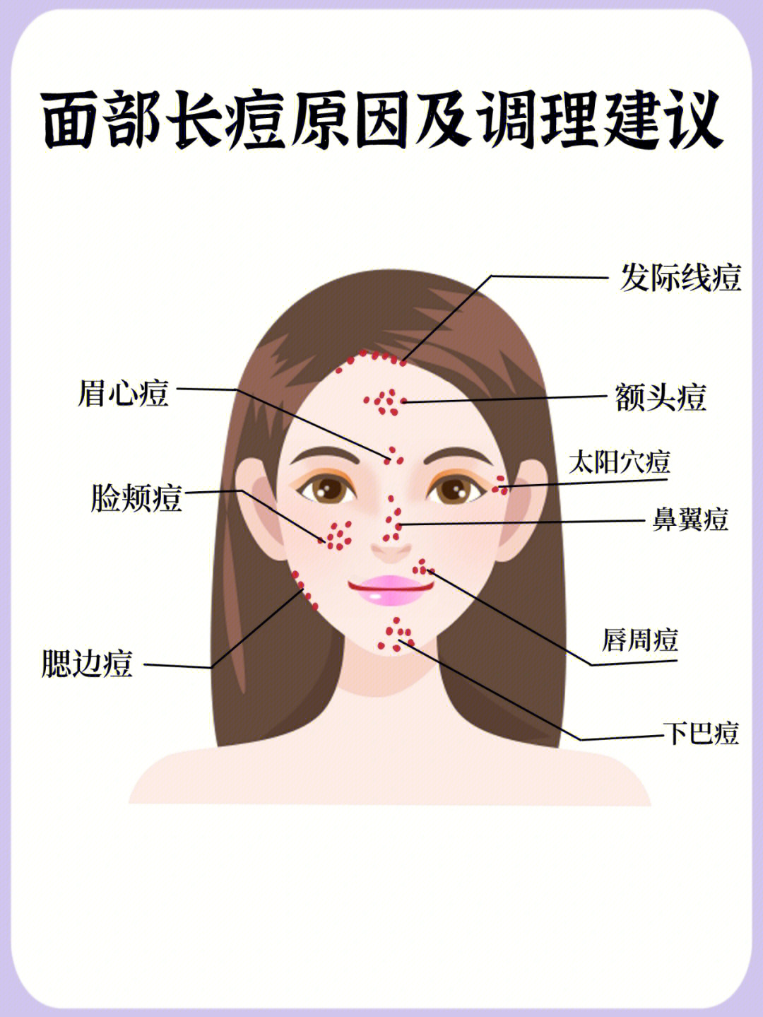 面部各处长痘原因及调理建议