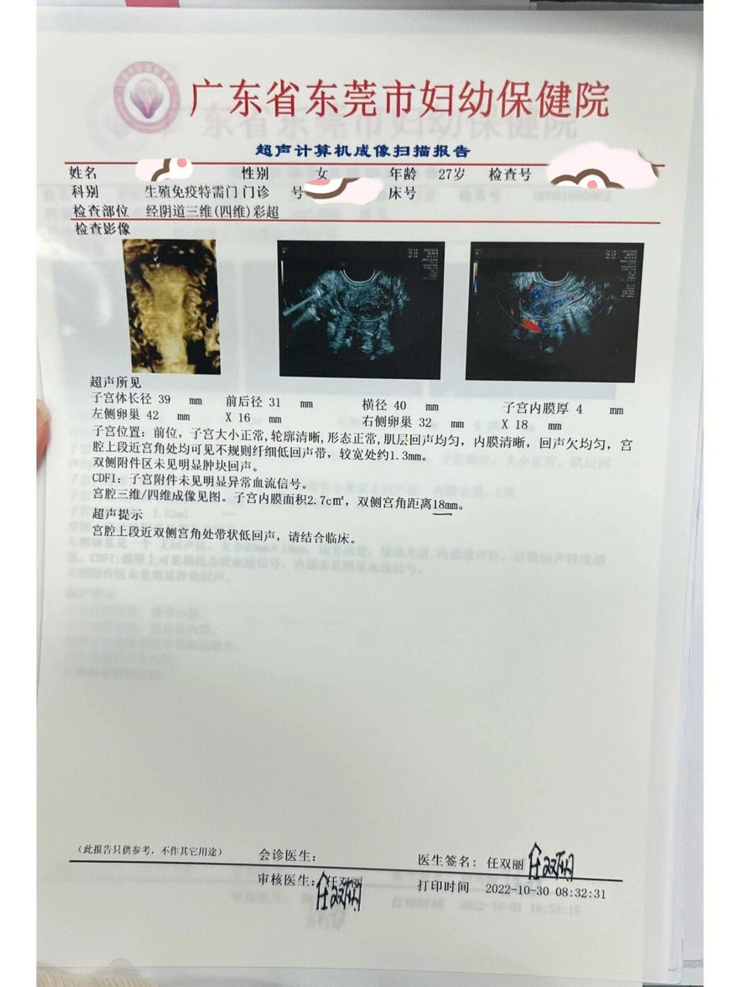 宫腔分离2mm图片