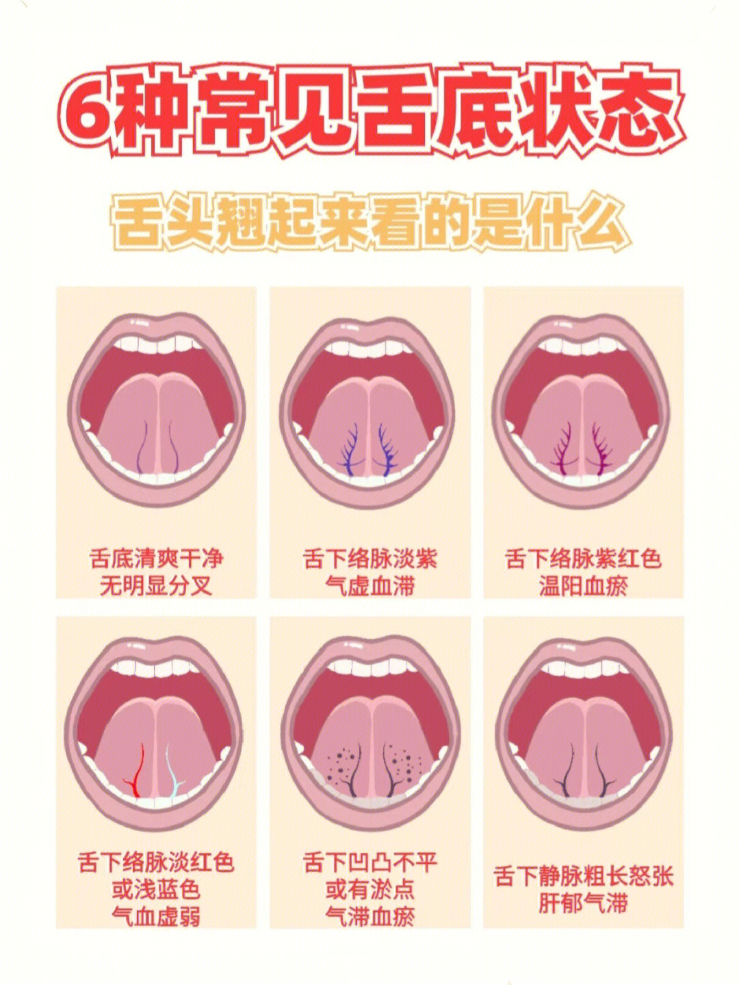 舌底结构图片