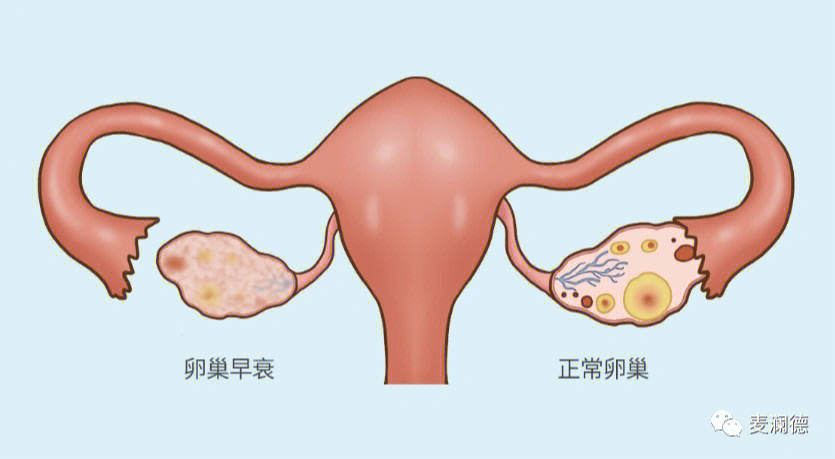 卵巢养不好女人老的快