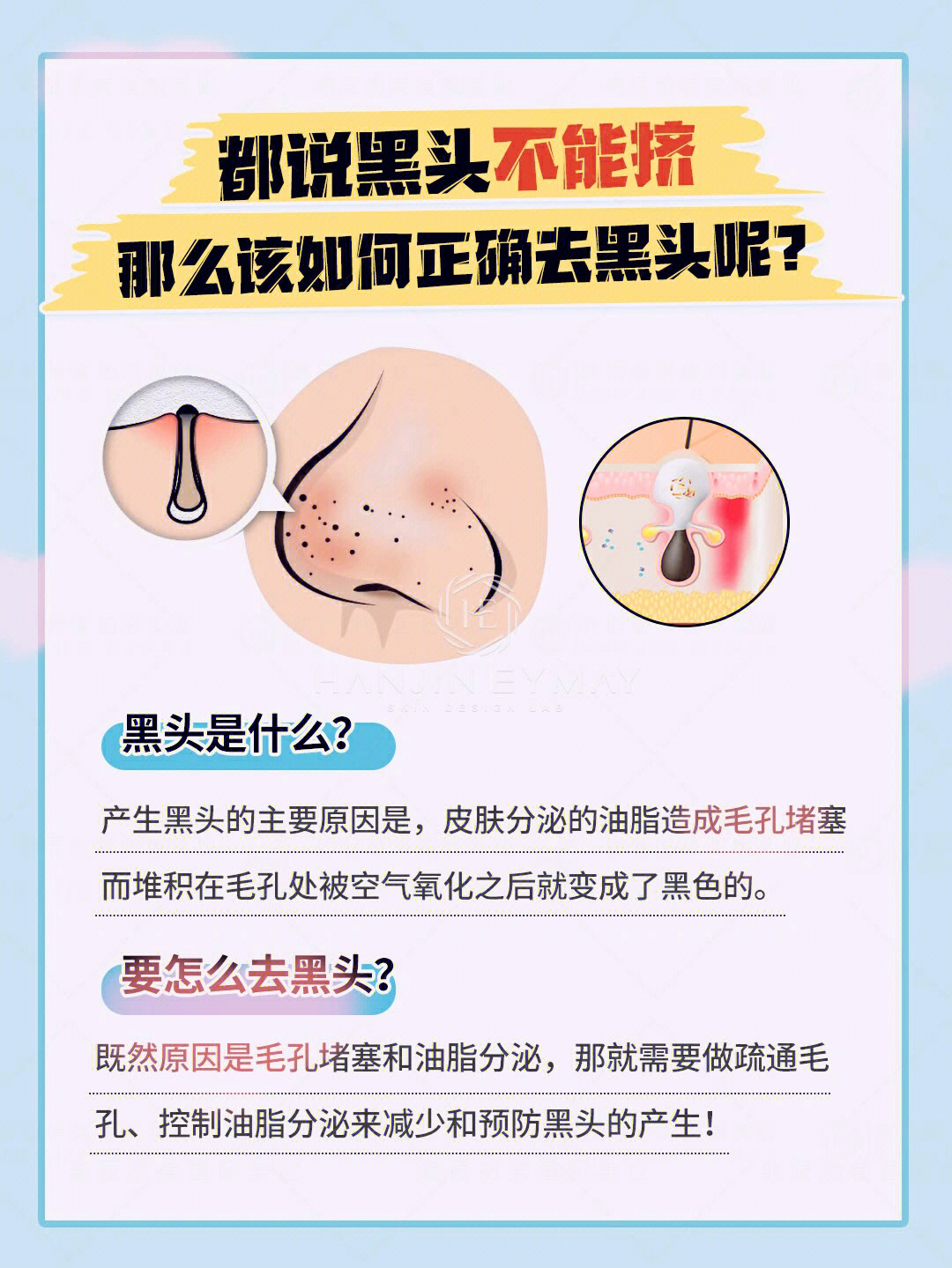 鼻子上的黑头怎么去掉图片