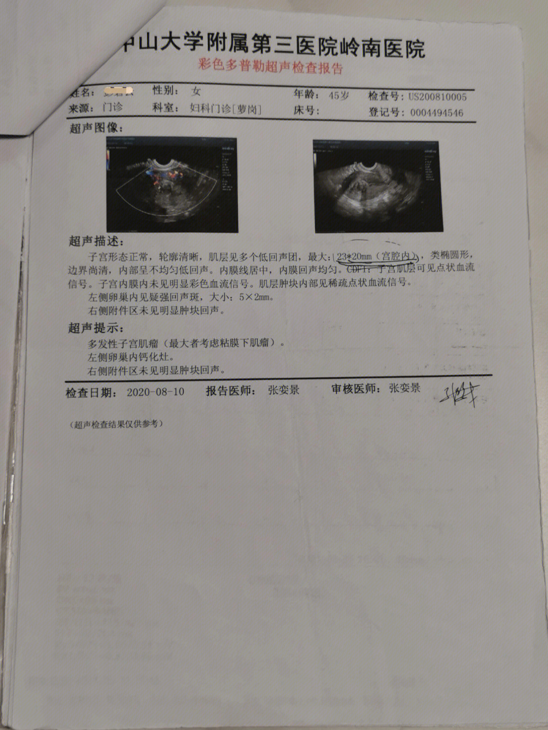 广州哪家医院做妇科子宫肌瘤手术好