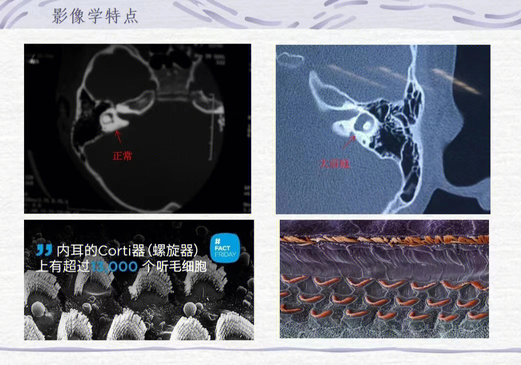 进入秋冬季要注意孩子大前庭容易复发的因素