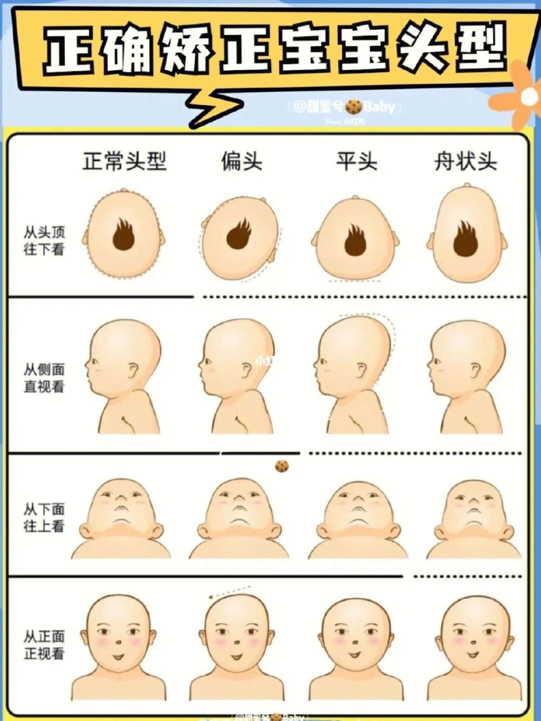 宝宝的头型不完美到底要不要矫正