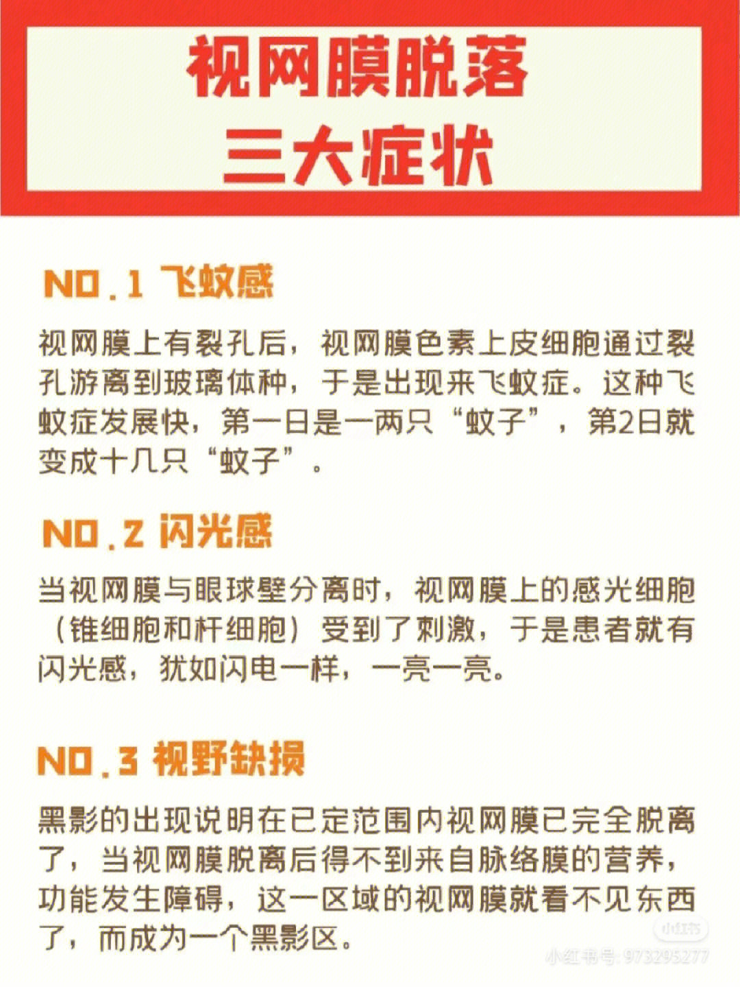 视网膜脱落的早期症状图片