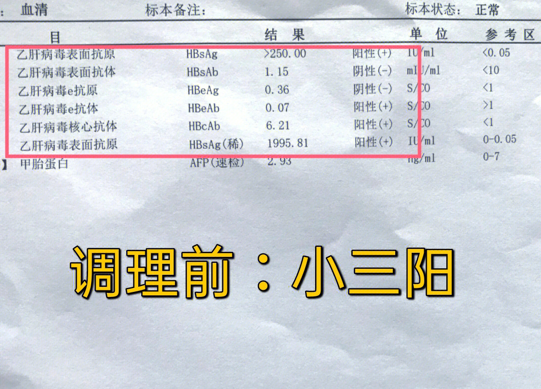 7月小三阳患者转阴案例转氨酶也恢复正常