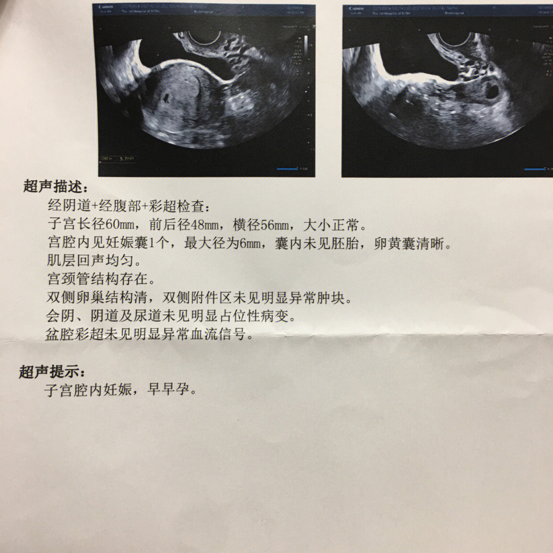 自己不能生8月末开始玩排卵试纸每天早晚测1次,测了不到十天预计9