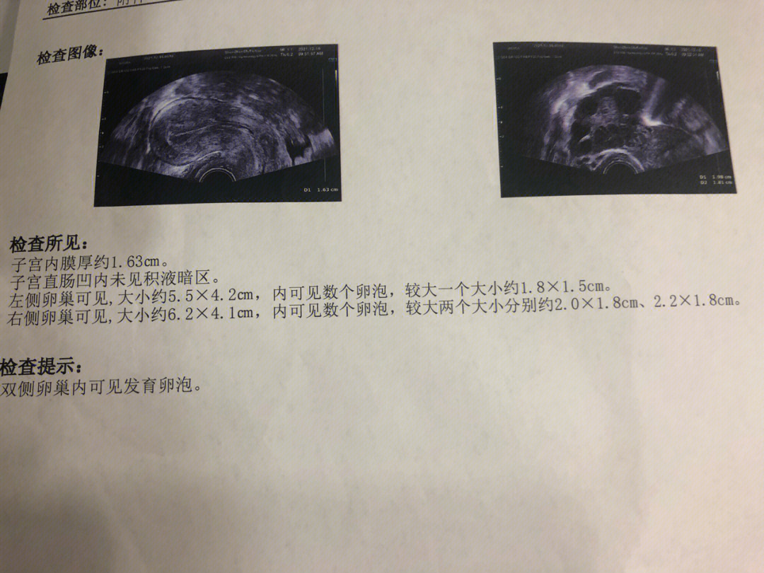 孕15周子宫大小及位置图片