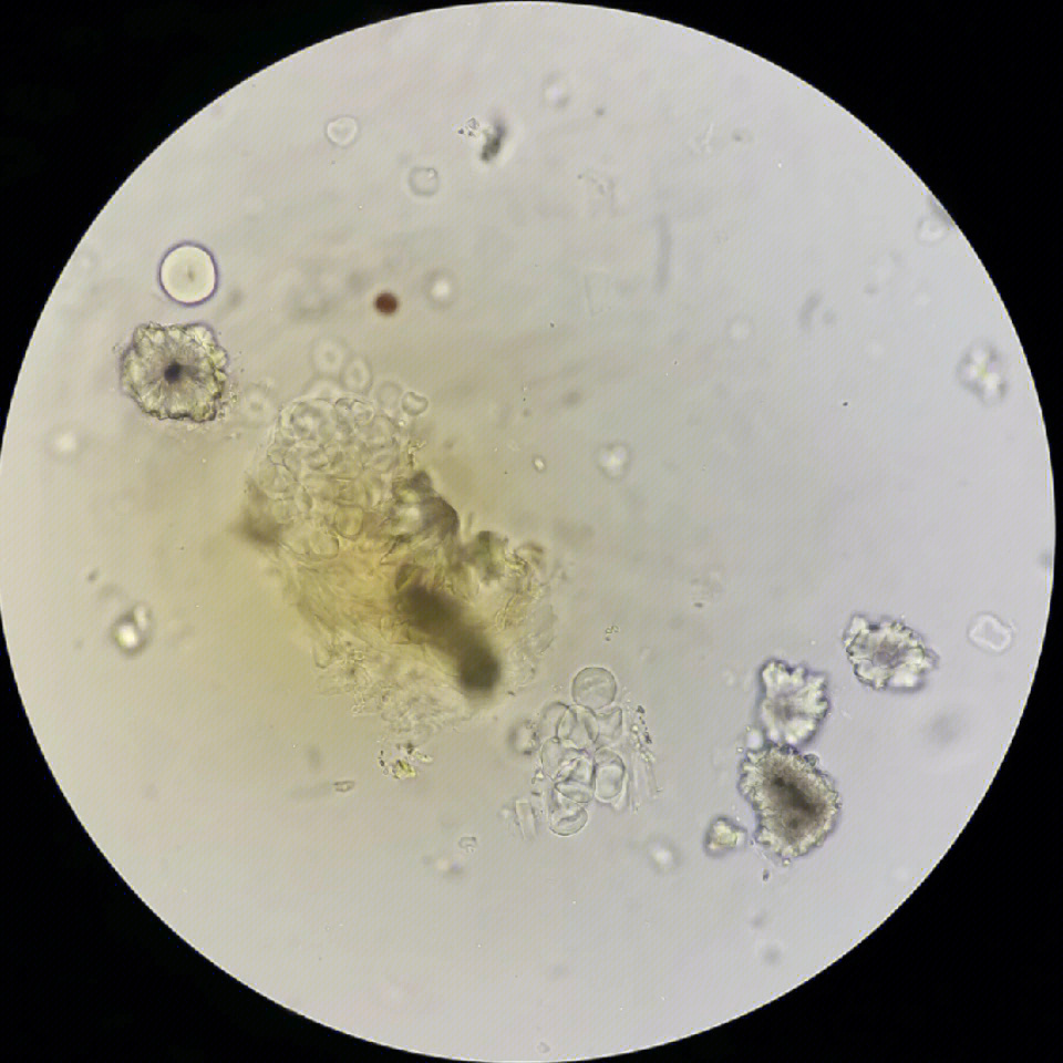 大黄粉末显微镜简图图片