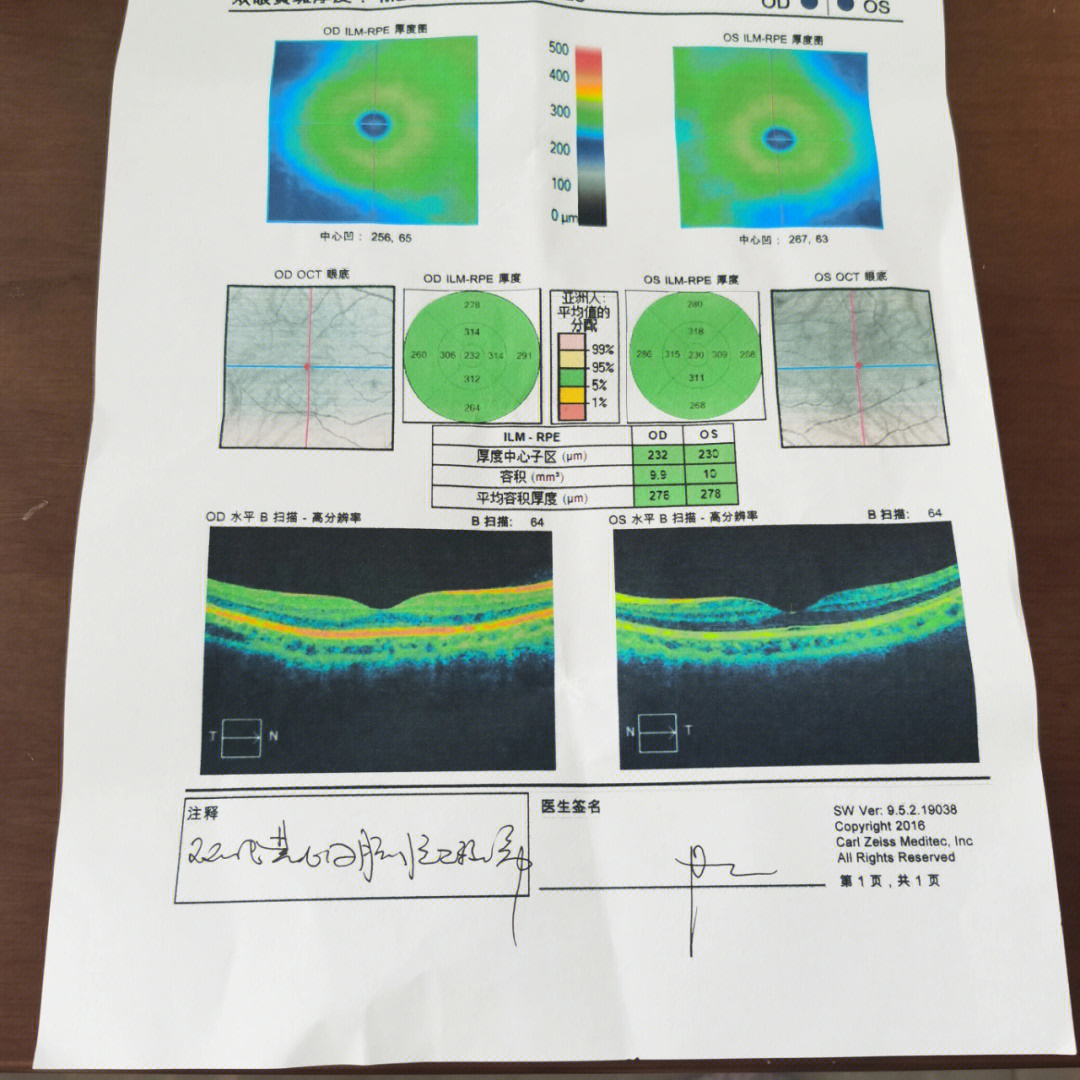 正常的眼科视野报告图图片