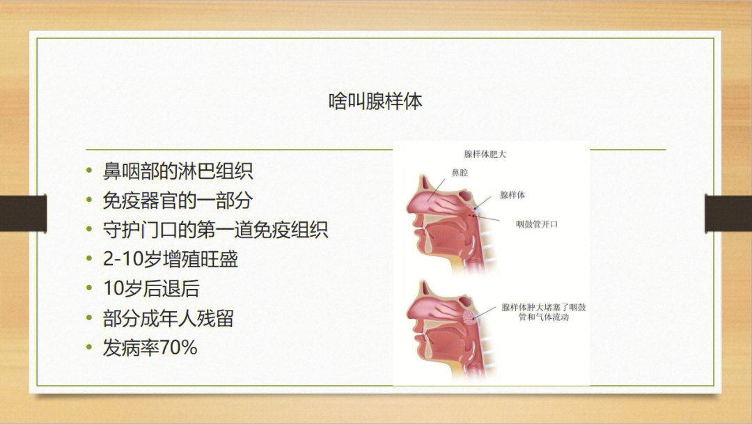 中医科普速成班课件分享1腺样体肥大