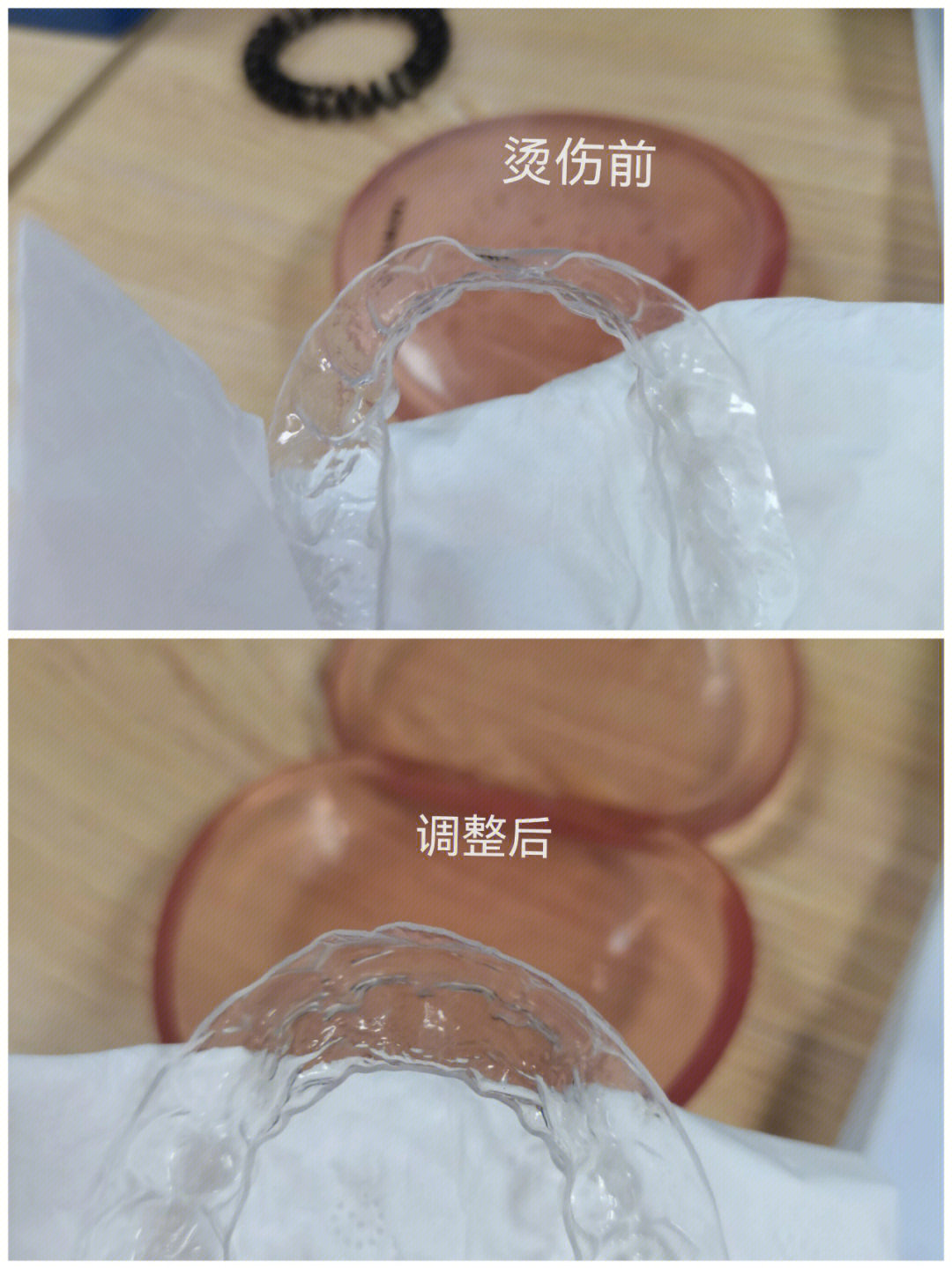 保持器后续立省500