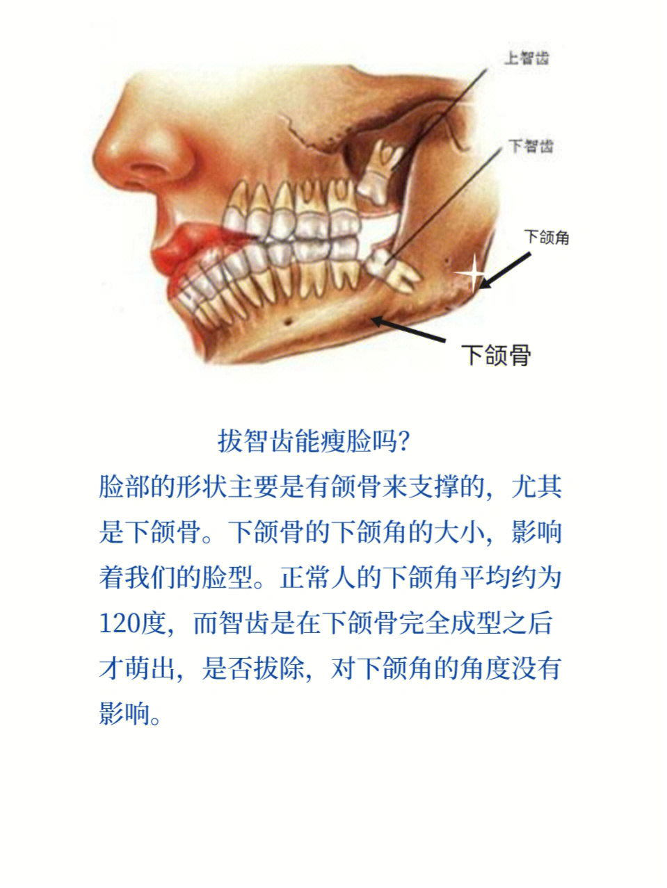 拔智齿脸会变小吗