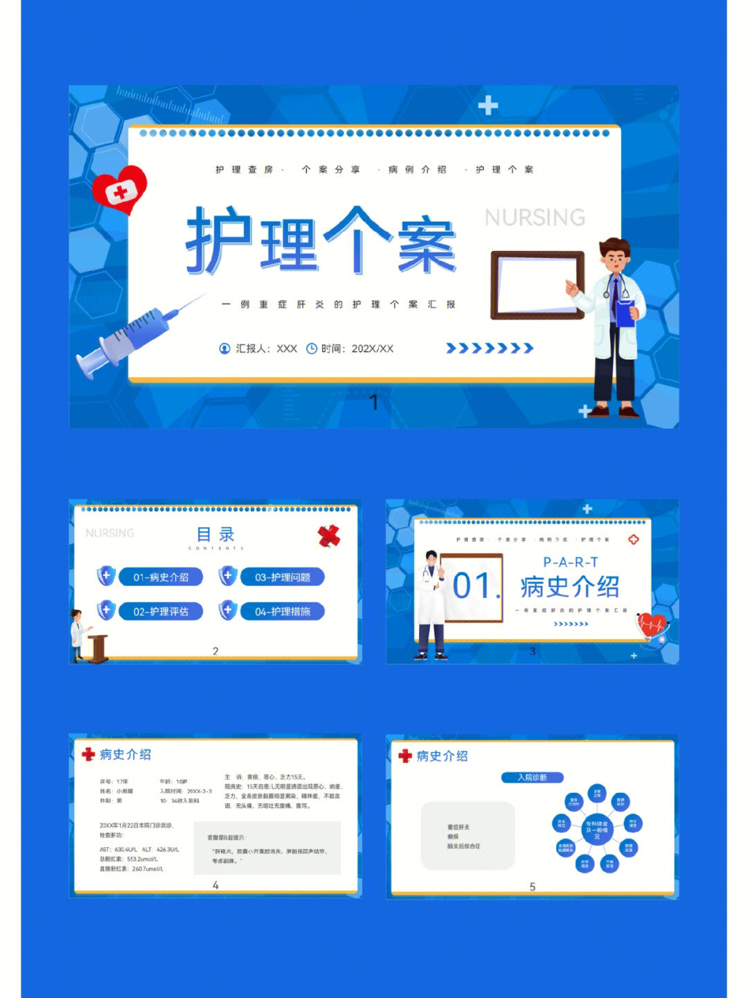 重症肝炎护理个案分析ppt模板