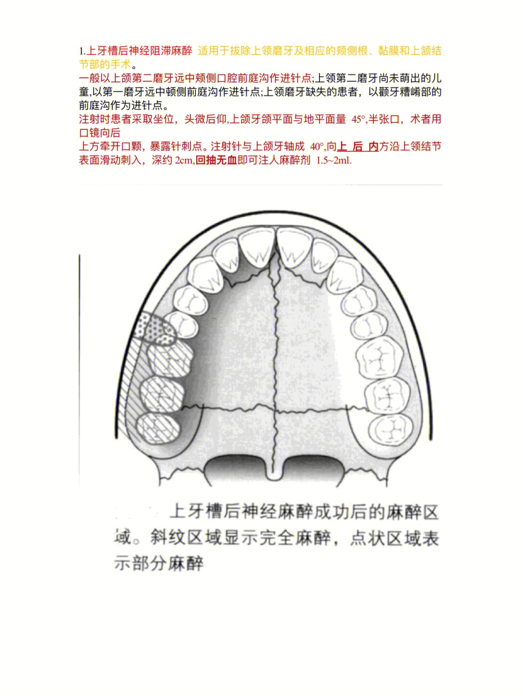 上颌前庭沟位置图图片