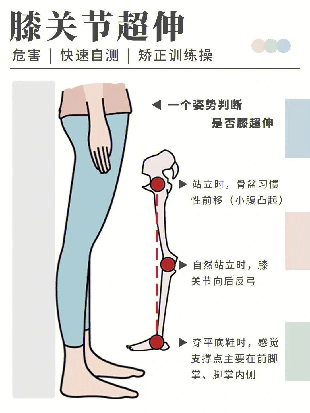 膝超伸的危害,自测方法以及矫正的训练动作