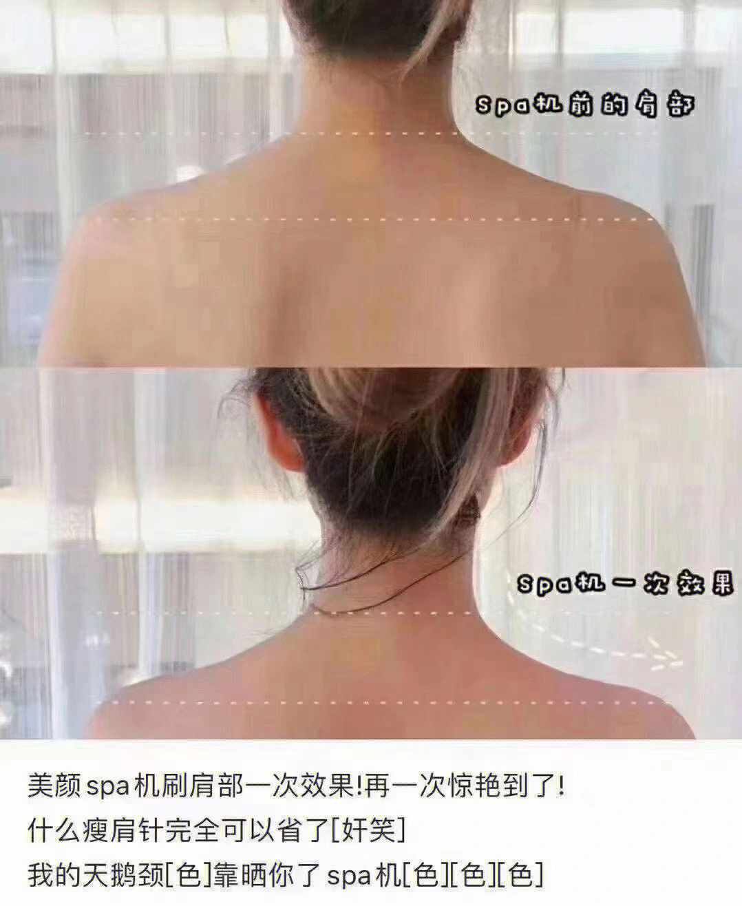 瘦腿针海报图片