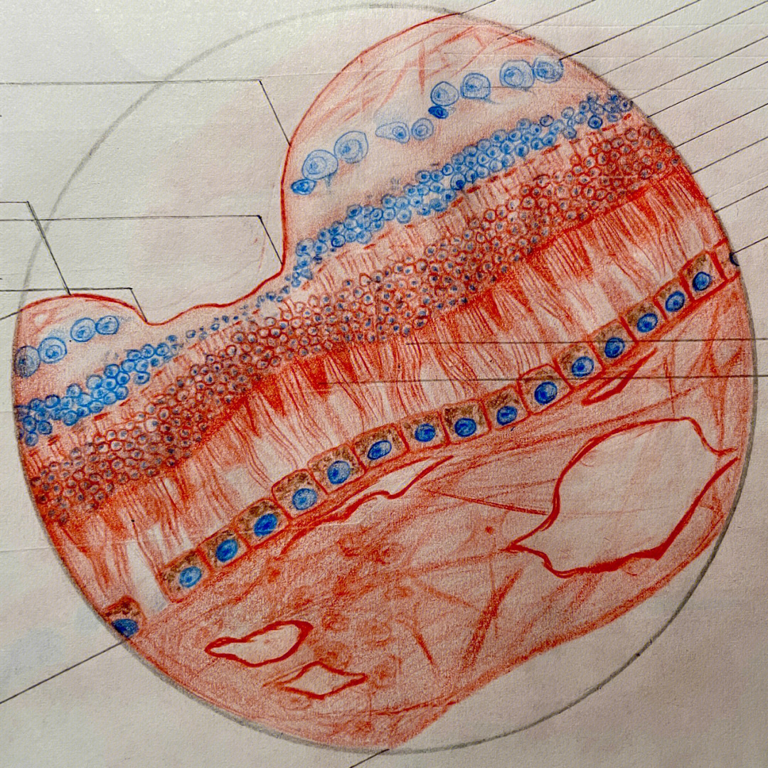 视网膜光镜图红蓝铅笔图片