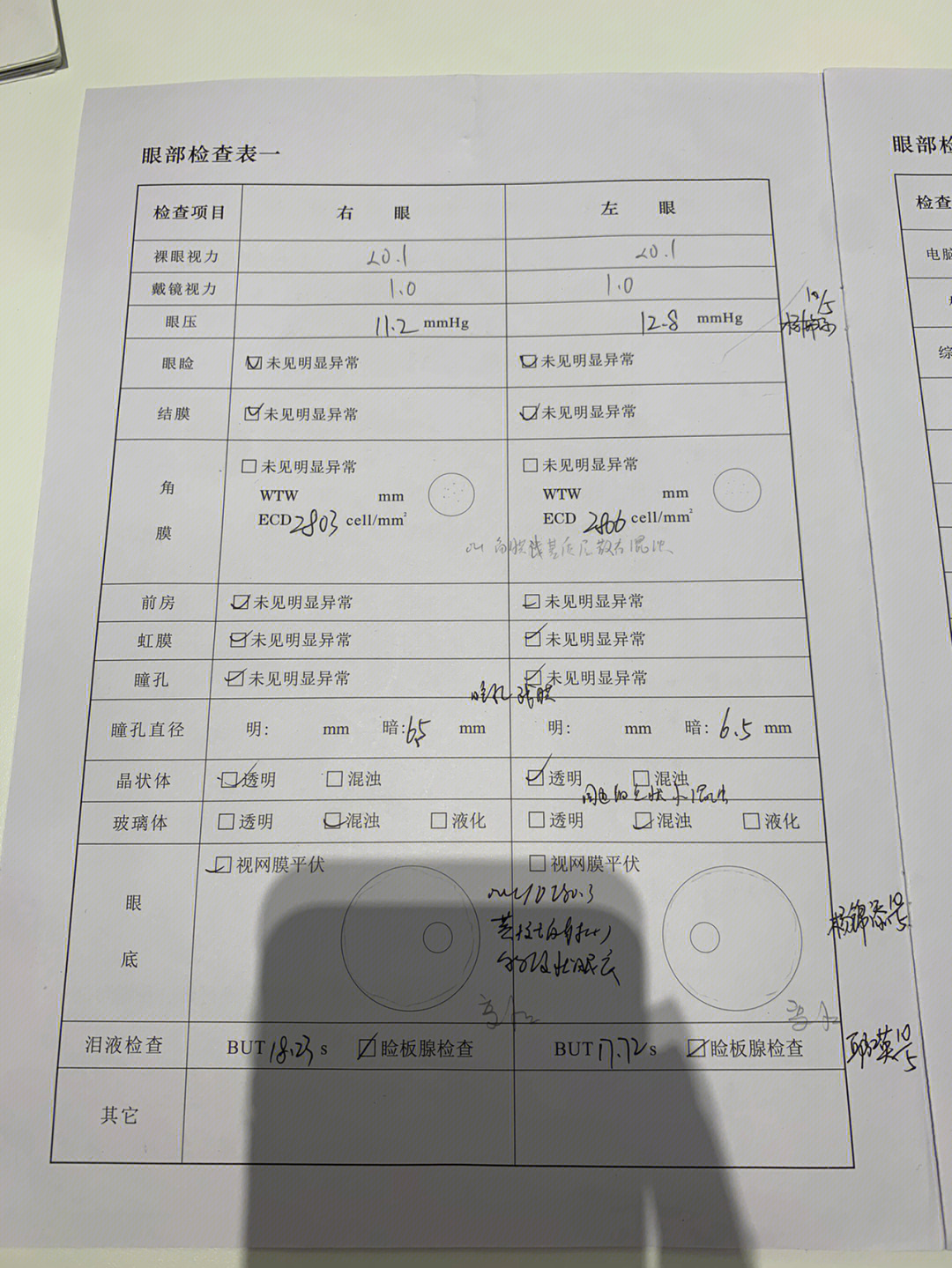 眼科设备大全 清单图片