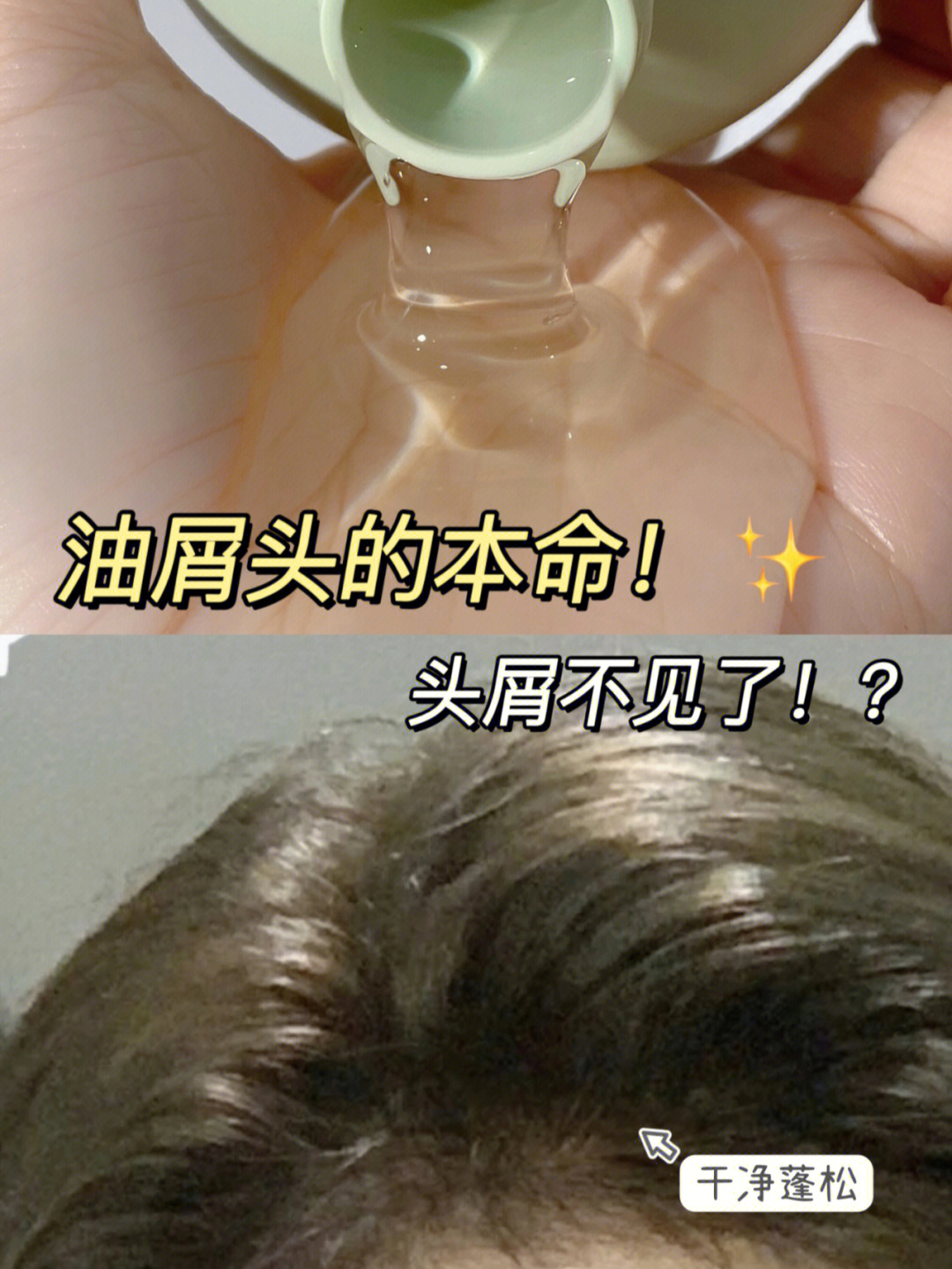 和去屑的效果都很赞91