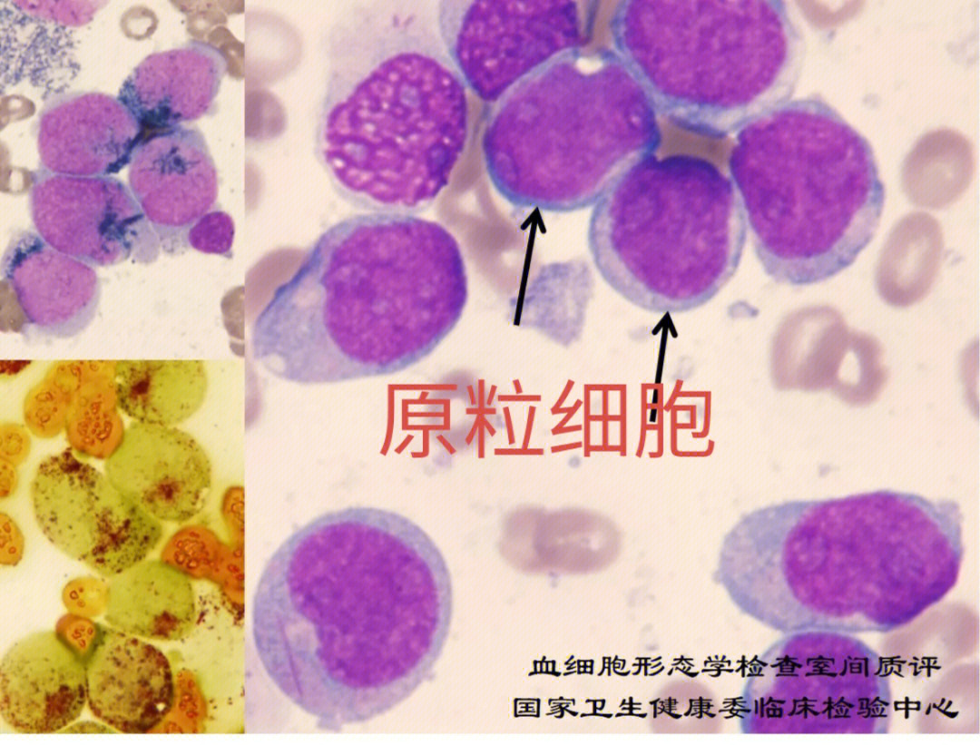 原始红细胞特点图片