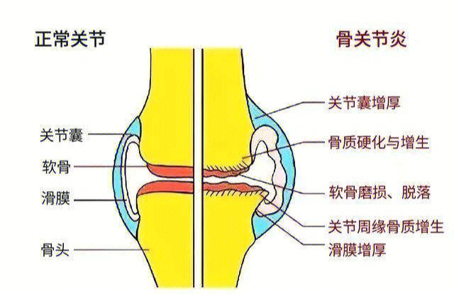 膝盖结构图图片